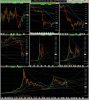 btcusd 2020 0317 2027.jpg